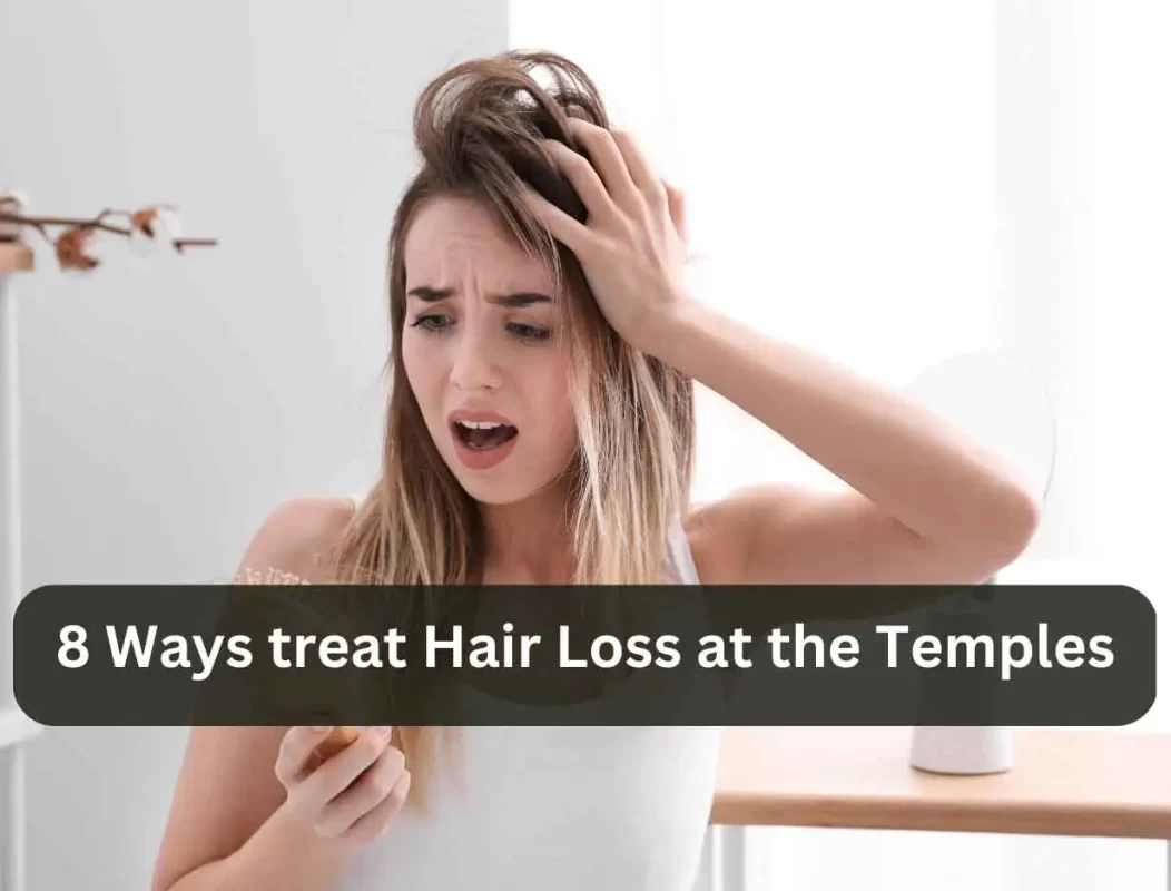 hair loss temples