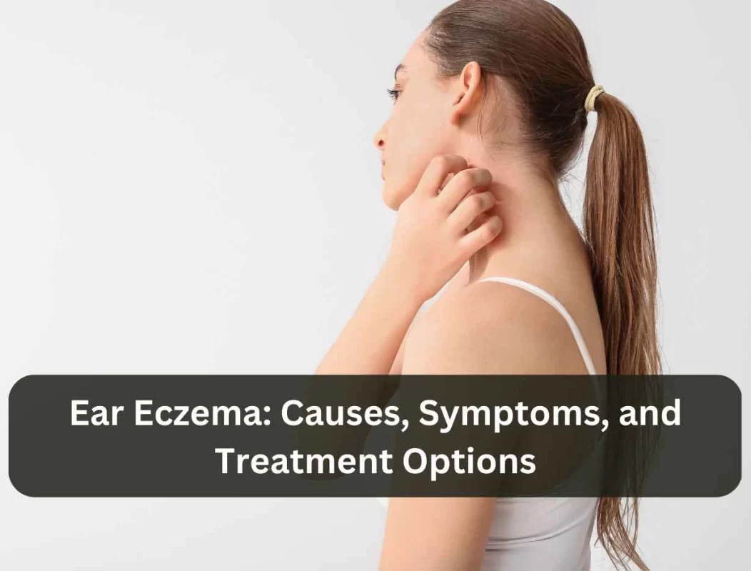 Ear Eczema | Saqib.co.in