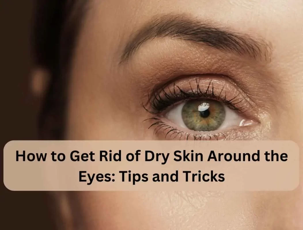 Dry Skin Around The Eyes