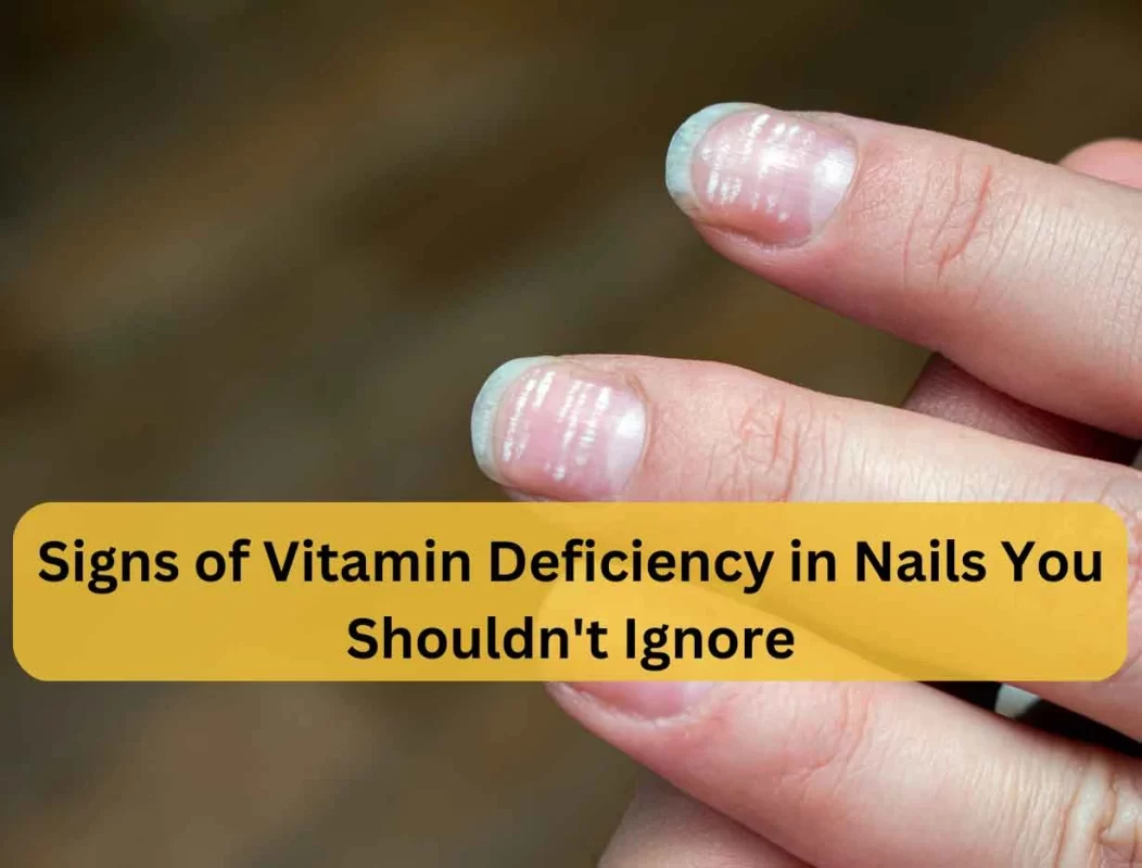 signs of vitamin deficiency in nails